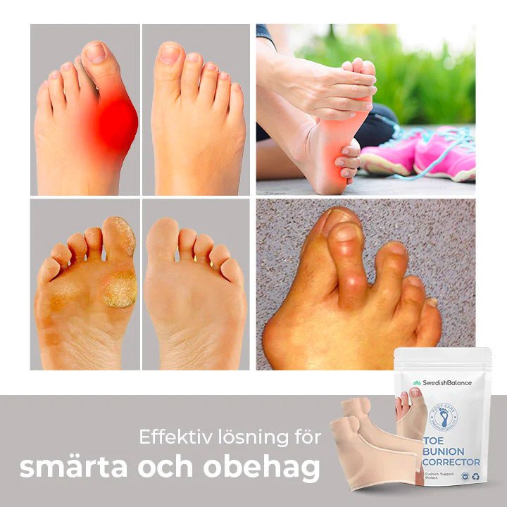 Hallux valgus-korrigerare - swedishbalance